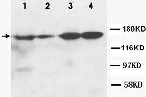 Western Blot analysis of ROCK2 expression from cell extracts with ROCK2 polyclonal antibody .