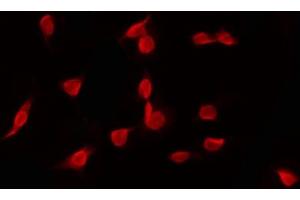 ABIN6268797 staining HT29 by IF/ICC. (EZH1 anticorps  (Internal Region))