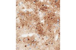 Immunohistochemical analysis of paraffin-embedded human brain tissue using B performed on the Leica® BOND RXm. (GFAP anticorps)