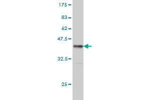 Western Blot detection against Immunogen (37.
