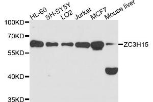 Western blot analysis of extracts of various cell lines, using ZC3H15 antibody (ABIN6003752) at 1/1000 dilution. (ZC3H15 anticorps)