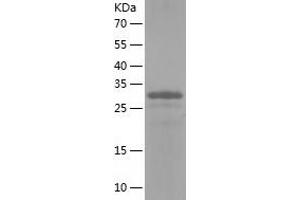 Western Blotting (WB) image for Low Density Lipoprotein Receptor Adaptor Protein 1 (LDLRAP1) (AA 1-308) protein (His tag) (ABIN7123786) (LDLRAP1 Protein (AA 1-308) (His tag))
