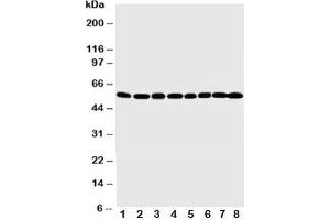Western blot testing of MDM2 antibody and Lane 1:  rat testis;  2: rat brain;  3: rat heart;  4: SKOV-3;  5: Colo320;  6: HeLa;  7: HEPA;  8: COS7 cell lysate