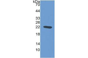 WB of Protein Standard: different control antibodies  against Highly purified E. (NOS2 Kit ELISA)
