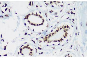Immunohistochemistry of paraffin-embedded Human breast using TriMethyl-Histone H3-K64 Polyclonal Antibody at dilution of 1:100 (40x lens).