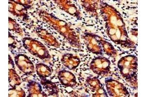 Immunohistochemistry of paraffin-embedded human small intestine tissue using ABIN7174631 at dilution of 1:100