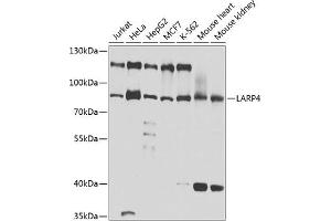 Western blot analysis of extracts of various cell lines, using L antibody (ABIN6132079, ABIN6143092, ABIN6143093 and ABIN6220849) at 1:1000 dilution. (LARP4 anticorps  (AA 1-120))