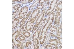 Immunohistochemistry of paraffin-embedded mouse kidney using Erlin-2 Rabbit mAb (ABIN7267006) at dilution of 1:100 (40x lens).