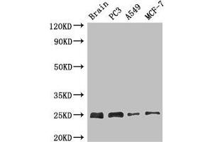 Western Blot Positive WB detected in: Mouse brain tissue, PC-3 whole cell lysate, A549 whole cell lysate, MCF-7 whole cell lysate All lanes: APOPT1 antibody at 2. (APOPT1 anticorps  (AA 40-150))