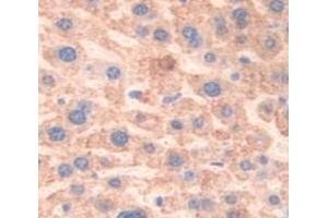 IHC-P analysis of Mouse Tissue, with DAB staining. (LCAT anticorps  (AA 290-432))