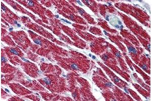 Human Heart: Formalin-Fixed, Paraffin-Embedded (FFPE)