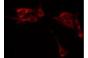 ABIN6267412 staining HeLa by IF/ICC.