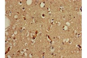 Immunohistochemistry of paraffin-embedded human brain tissue using ABIN7164093 at dilution of 1:100 (PRDM2 anticorps  (AA 733-961))