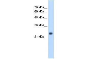 WB Suggested Anti-NNMT Antibody Titration:  2.