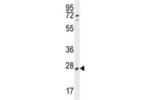 RPEL1 antibody western blot analysis in K562 lysate (Ribulose-5-Phosphate-3-Epimerase-Like (RPEL1) (AA 187-215) anticorps)