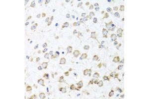 Immunohistochemistry of paraffin-embedded mouse brain using RPL36 antibody.