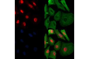Phospho-SAMHD1 (Thr592) Antibody staining A549 cells(H2O2 treatment) by IF/ICC. (SAMHD1 anticorps  (pThr592))