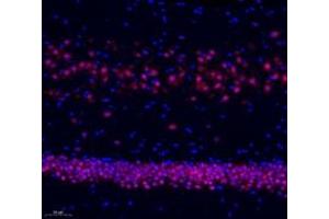 Immunofluorescence of paraffin embedded rat hippocampus using neun (ABIN7075479) at dilution of 1: 500 (200x lens) (NeuN anticorps)
