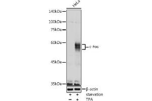 Western blot analysis of extracts of HeLa cells, using c-Fos antibody (ABIN3020747, ABIN3020748, ABIN3020749, ABIN1512925 and ABIN6213704) at 1:1000 dilution. (c-FOS anticorps  (AA 211-380))