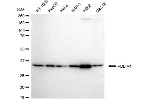 Western blotting analysis using PDLIM1 antibody (ABIN7799748). (Recombinant PDLIM1 anticorps)