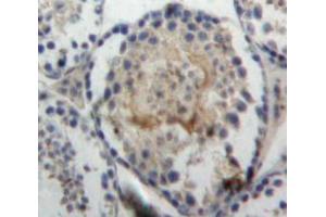 Used in DAB staining on fromalin fixed paraffin-embedded Testis tissue