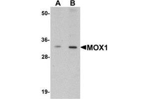 Western blot analysis of MOX1 in human liver tissue lysate with MOX1 antibody at (A) 1 and (B) 2 μg/ml.