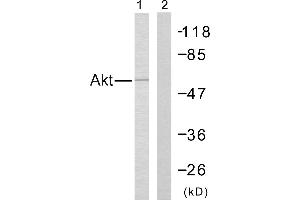 Western blot analysis of the extracts from Jurkat cells using Akt (Ab-308) antibody (#B7005). (AKT1 anticorps  (Thr308))