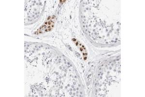 Immunohistochemical staining of human testis with GBP6 polyclonal antibody  shows strong cytoplasmic positivity in Leydig cells. (GBP6 anticorps)