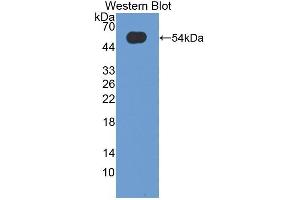 Detection of Recombinant OSM, Human using Polyclonal Antibody to Oncostatin M (OSM)