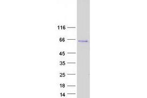 Validation with Western Blot