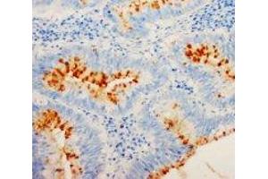 Image no. 1 for anti-Cyclin-Dependent Kinase Inhibitor 1B (p27, Kip1) (CDKN1B) (C-Term) antibody (ABIN1492939) (CDKN1B anticorps  (C-Term))