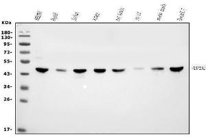 Western blot analysis of MEK2/MAP2K2 using anti-MEK2/MAP2K2 antibody (ABIN7599355).