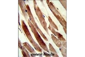 Formalin-fixed and paraffin-embedded human skeletal muscle reacted with TAGLN Antibody (N-term), which was peroxidase-conjugated to the secondary antibody, followed by DAB staining. (Transgelin anticorps  (N-Term))