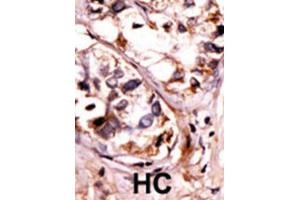Immunohistochemistry (IHC) image for anti-Spleen tyrosine Kinase (SYK) (pThr526), (pTyr526) antibody (ABIN2913440)