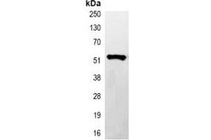 Immunoprecipitation of His-tagged protein from HEK293T cells transfected with vector overexpressing His tag, using Anti-His-tag Antibody.