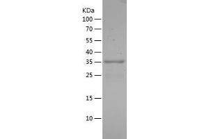 Western Blotting (WB) image for Forkhead Box O1 (FOXO1) (AA 353-655) protein (His tag) (ABIN7122993) (FOXO1 Protein (AA 353-655) (His tag))