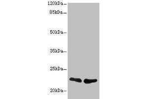 Western blot All lanes: TNFAIP8 antibody at 2.
