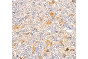 Immunohistochemistry of paraffin embedded rat epencephalon using AMIGO2 (ABIN7072966) at dilution of 1: 1300 (400x lens)