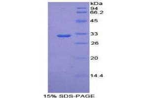 SDS-PAGE (SDS) image for phosphoenolpyruvate Carboxykinase 1 (Soluble) (PCK1) (AA 312-563) protein (His tag) (ABIN2126277) (PCK1 Protein (AA 312-563) (His tag))