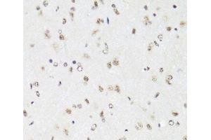 Immunohistochemistry of paraffin-embedded Mouse brain using EFTUD2 Polyclonal Antibody at dilution of 1:100 (40x lens).