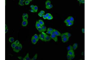 Immunofluorescence staining of PC-3 cells with ABIN7153683 at 1:100, counter-stained with DAPI. (GRPR anticorps  (AA 326-384))