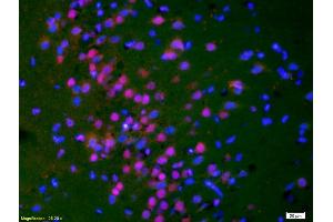 Formalin-fixed and paraffin-embedded rat brain labeled with Anti-Phospho-HER3 (Tyr1289) Polyclonal Antibody, Unconjugated (ABIN747113) 1:200, overnight at 4°C, The secondary antibody was Goat Anti-Rabbit IgG, Cy3 conjugated used at 1:200 dilution for 40 minutes at 37°C.