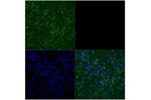 Primary metastatic Melenoma