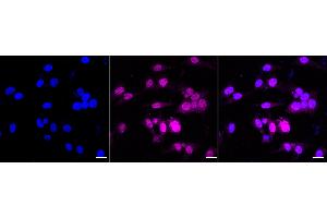 anti-Sestrin 1 (SESN1) antibody