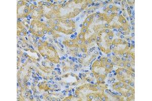 Immunohistochemistry of paraffin-embedded Mouse kidney using PGK1 Polyclonal Antibody at dilution of 1:100 (40x lens). (PGK1 anticorps)