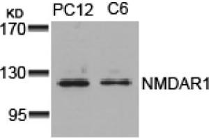 Image no. 1 for anti-NMDA Receptor 1 (NMDA R1) (AA 894-898) antibody (ABIN319312) (NMDA 1 Receptor anticorps  (AA 894-898))
