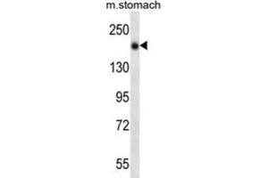 Western Blotting (WB) image for anti-Unc-13 Homolog B (UNC13B) antibody (ABIN2997152) (UNC13B anticorps)