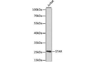 Western blot analysis of extracts of various cell lines using STAR Polyclonal Antibody at dilution of 1:1000. (STAR anticorps)