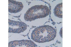 Used in DAB staining on fromalin fixed paraffin- embedded testis tissue