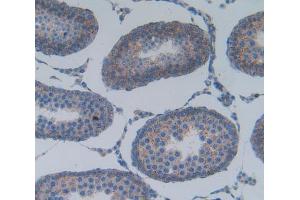 Used in DAB staining on fromalin fixed paraffin- embedded testis tissue (PLA2G2A anticorps  (AA 22-146))